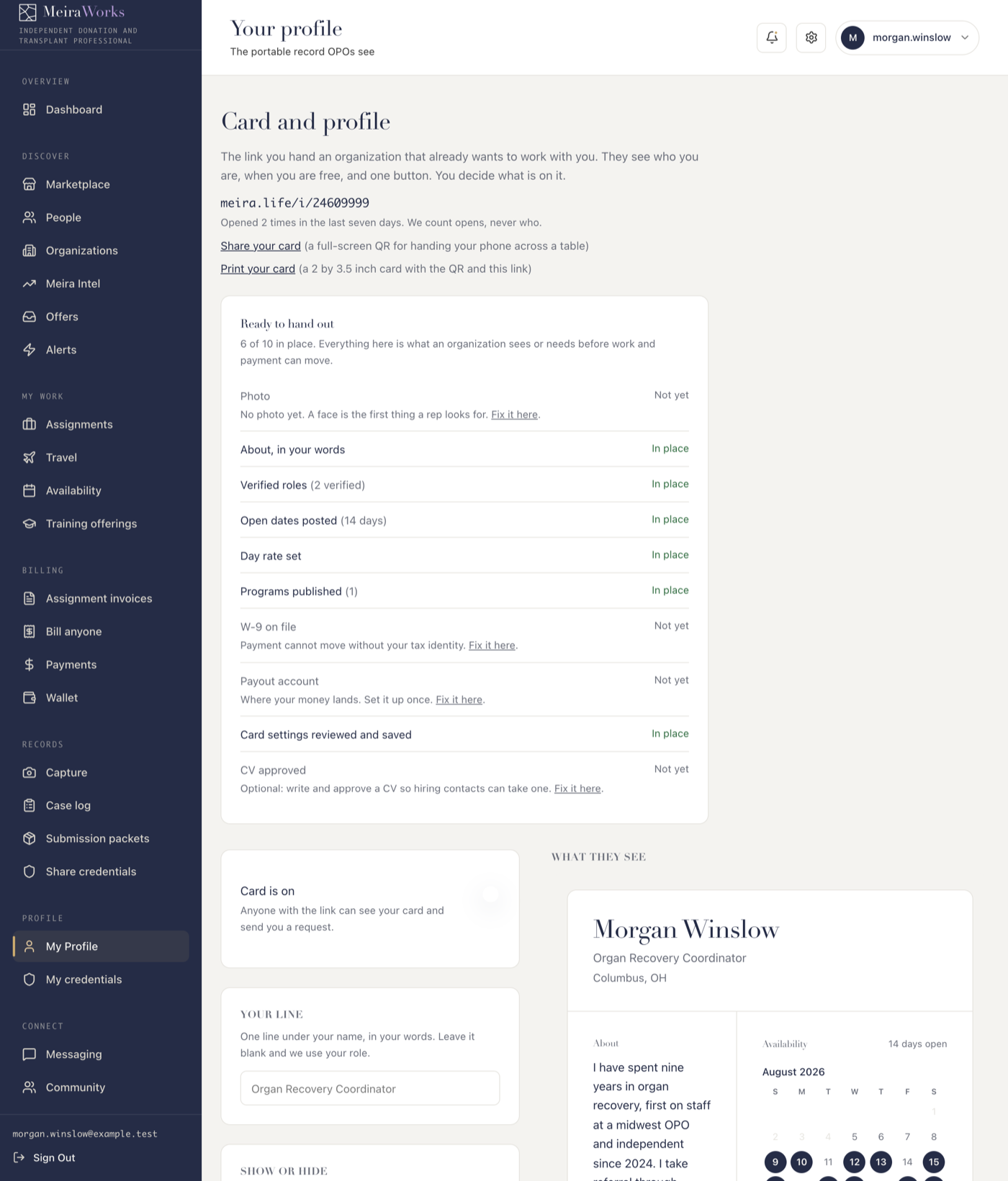 Card and profile settings with the on/off switch and per-field visibility toggles
